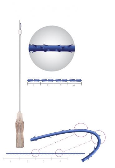 HEXA QUATTRO COG THREAD 21G X 90/160 MM