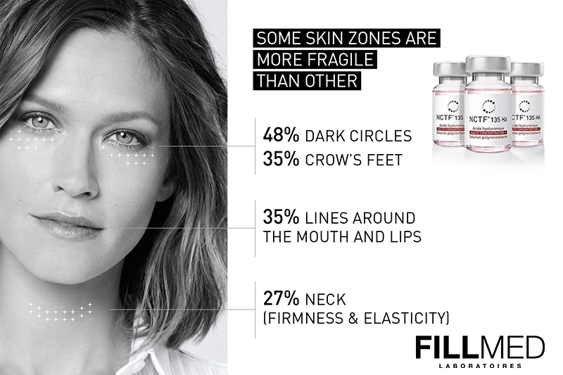 Mesotherapy – Not Only For The Face